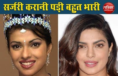Priyanka Chopra removed from several films due to nose and lip surgery