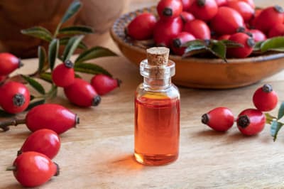 Rosehip Oil Benefits: आइए जानते हैं त्वचा के लिए रोजहिप ऑयल कितना फायदेमंद होता है