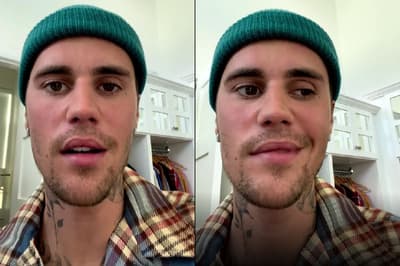 Justin Bieber के चेहरे का आधा हिस्सा हुआ पैरालिसिस