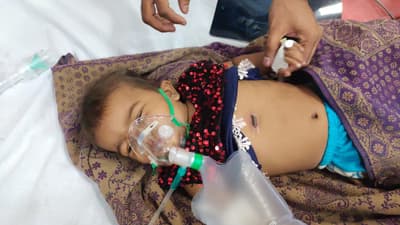 डाम का दंश: आठ माह की बच्ची को गर्म तार से दागा